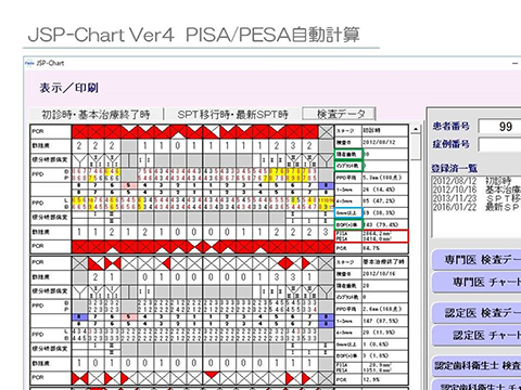 JSP-ChartVer3からVer4へのバージョンアップ内容